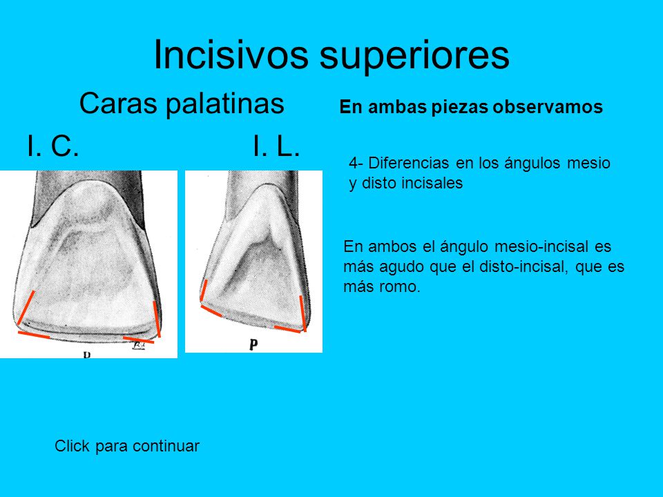 Caras palatinas En ambas piezas observamos I. C. I. L.