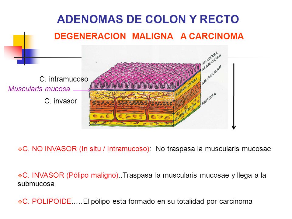 ADENOMAS DE COLON Y RECTO