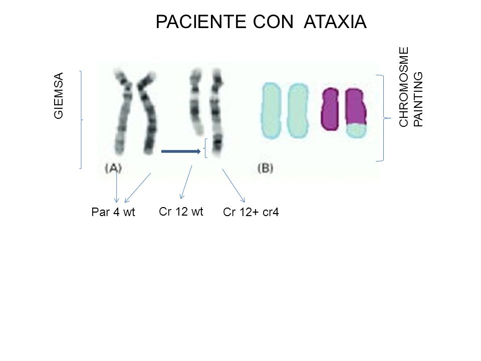 PACIENTE CON ATAXIA GIEMSA CHROMOSME PAINTING Par 4 wt Cr 12 wt