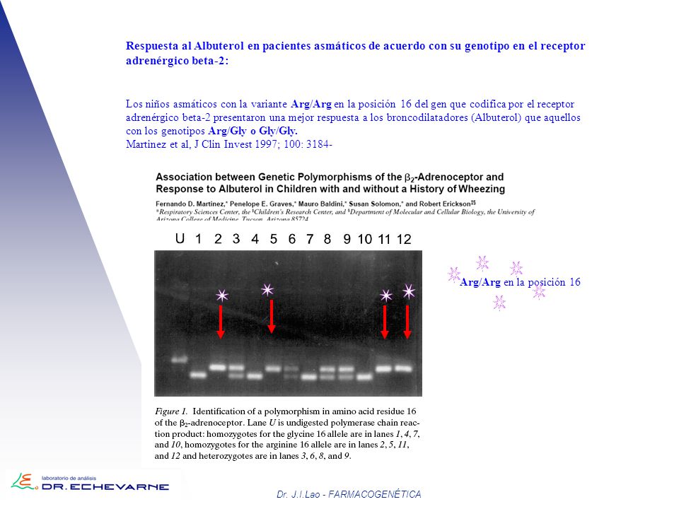 Respuesta al Albuterol en pacientes asmáticos de acuerdo con su genotipo en el receptor adrenérgico beta-2:
