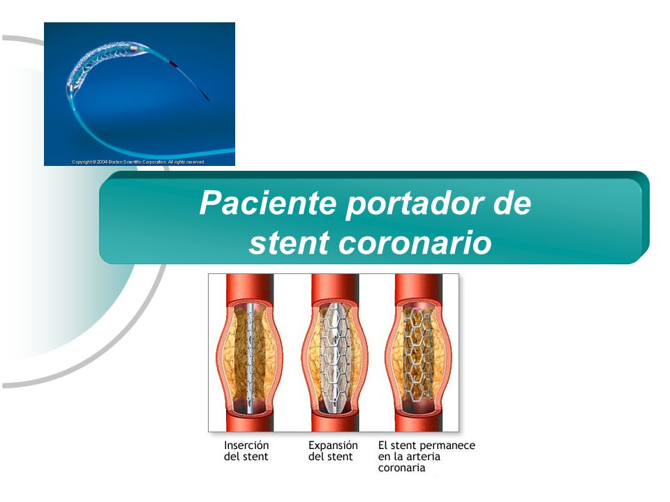 Paciente portador de stent coronario