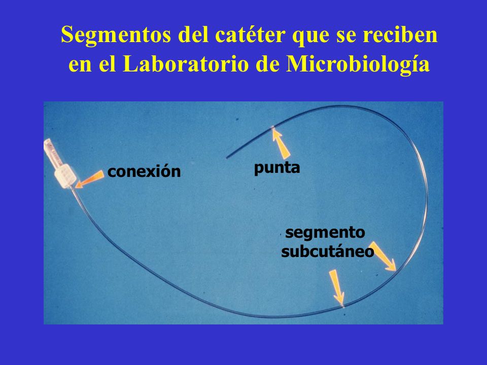Segmentos del catéter que se reciben en el Laboratorio de Microbiología