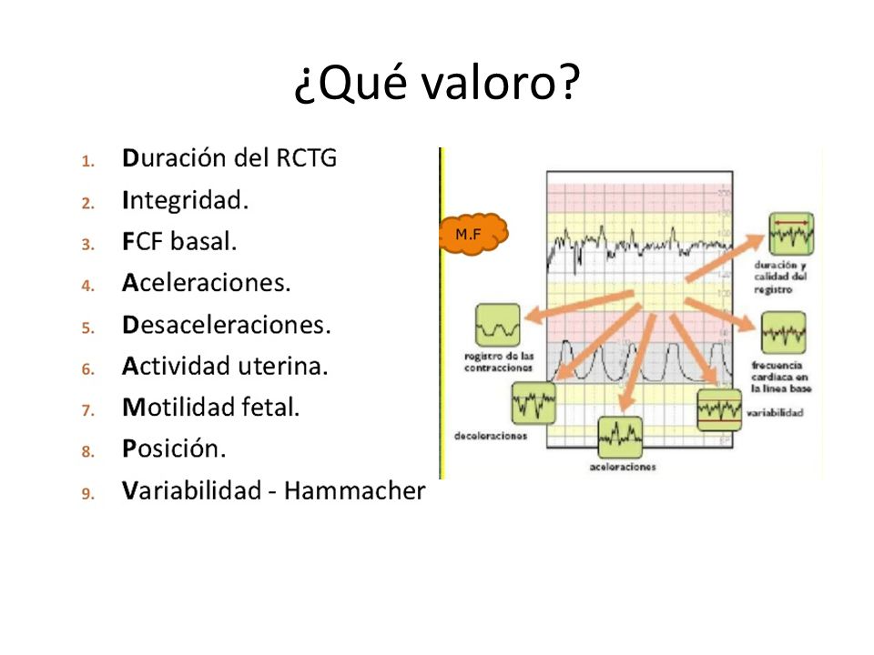 ¿Qué valoro