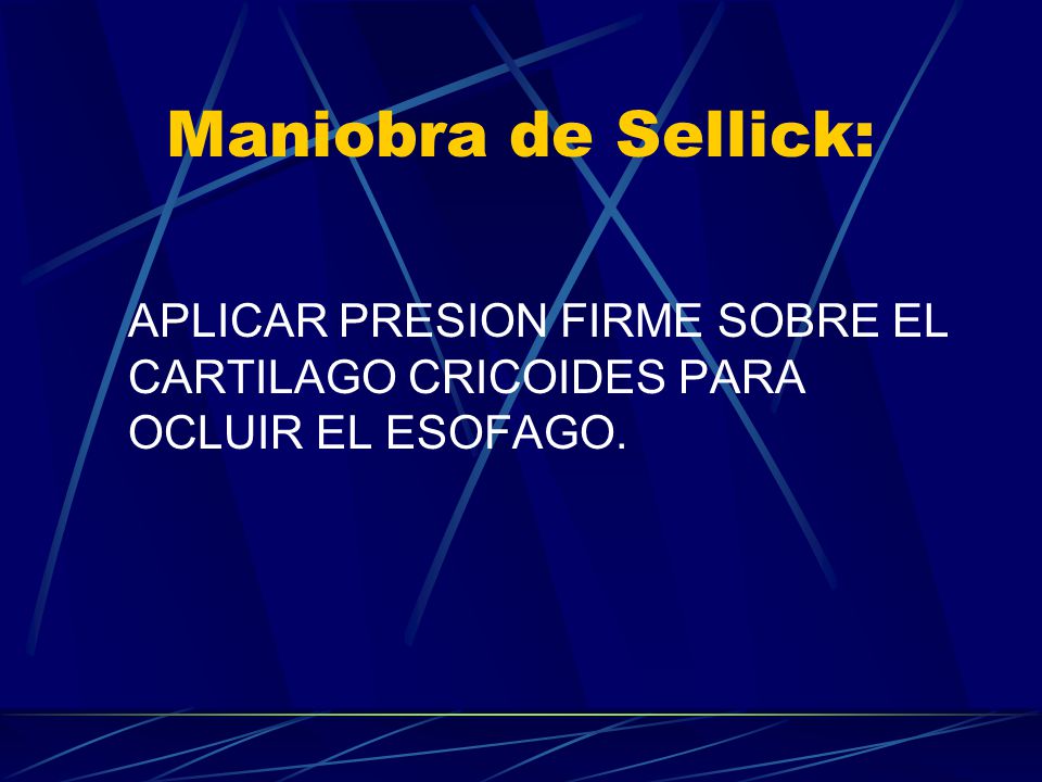 Maniobra de Sellick: APLICAR PRESION FIRME SOBRE EL CARTILAGO CRICOIDES PARA OCLUIR EL ESOFAGO.