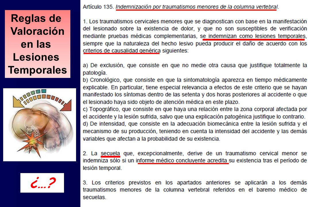 Reglas de Valoración en las Lesiones Temporales ¿…