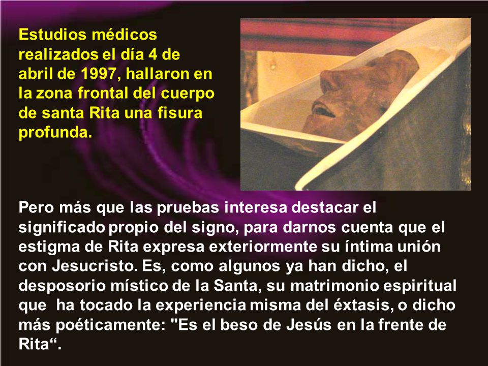 Estudios médicos realizados el día 4 de abril de 1997, hallaron en la zona frontal del cuerpo de santa Rita una fisura profunda.