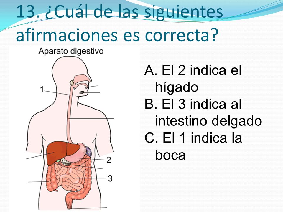13. ¿Cuál de las siguientes afirmaciones es correcta