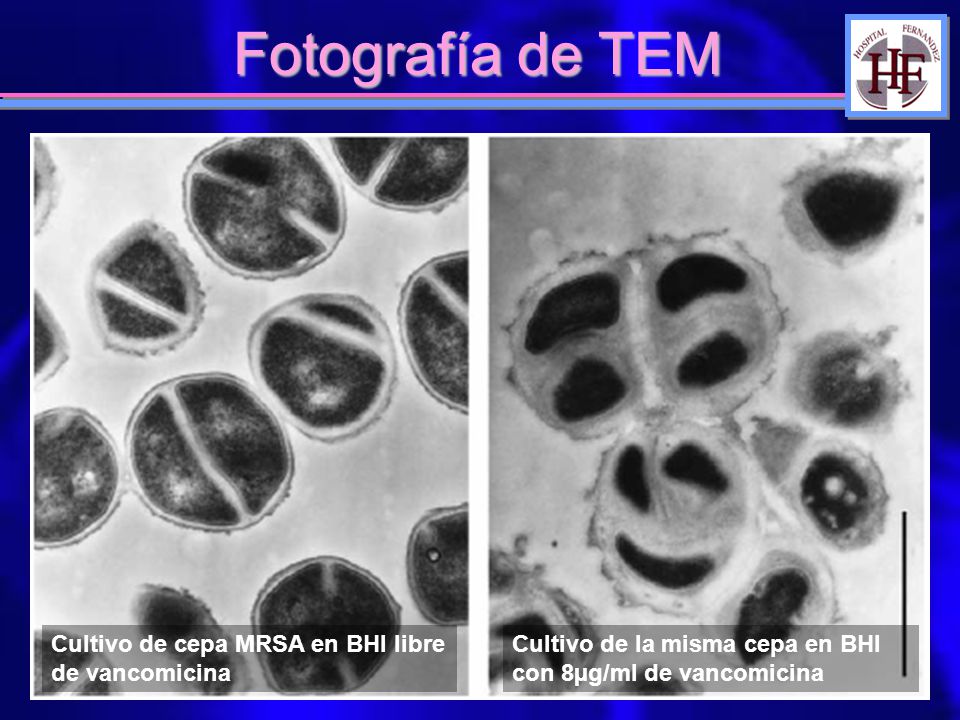 Fotografía de TEM Cultivo de cepa MRSA en BHI libre de vancomicina
