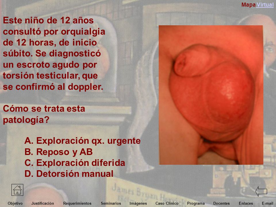 consultó por orquialgia de 12 horas, de inicio súbito. Se diagnosticó