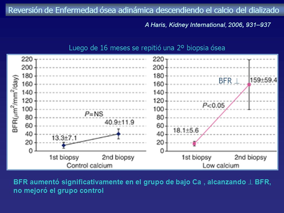 Reversión de Enfermedad ósea adinámica descendiendo el calcio del dializado