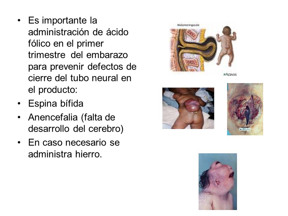 Es importante la administración de ácido fólico en el primer trimestre del embarazo para prevenir defectos de cierre del tubo neural en el producto: