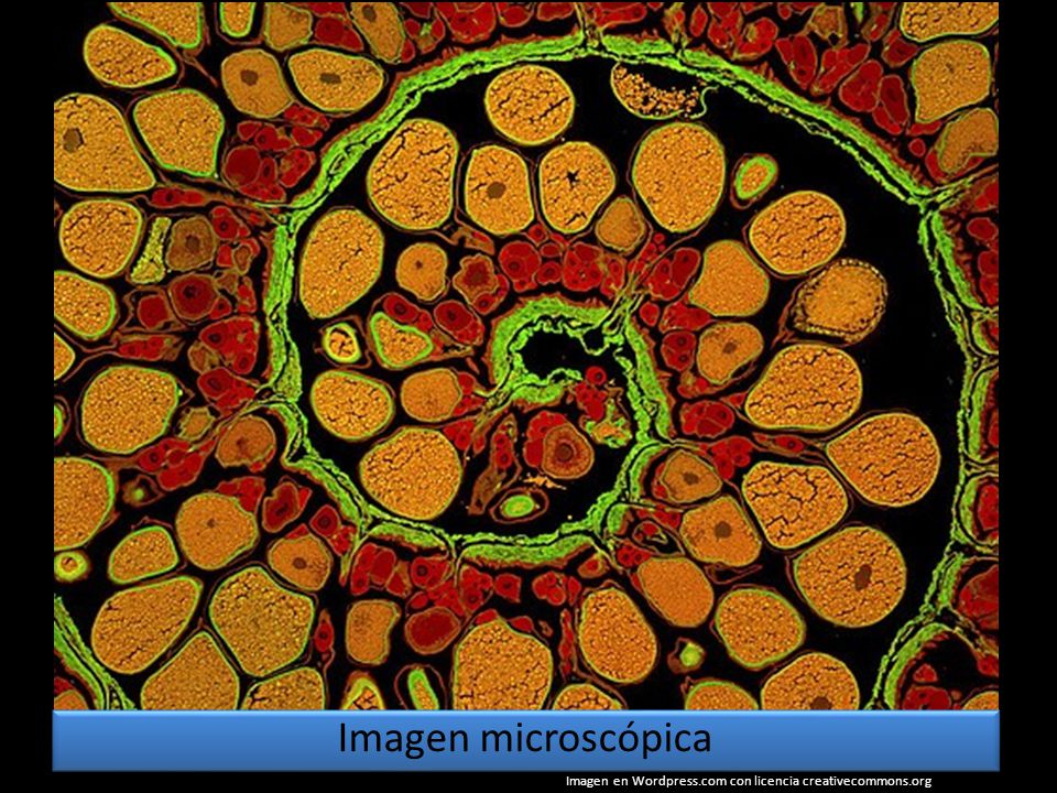 Imagen microscópica Imagen en Wordpress.com con licencia creativecommons.org