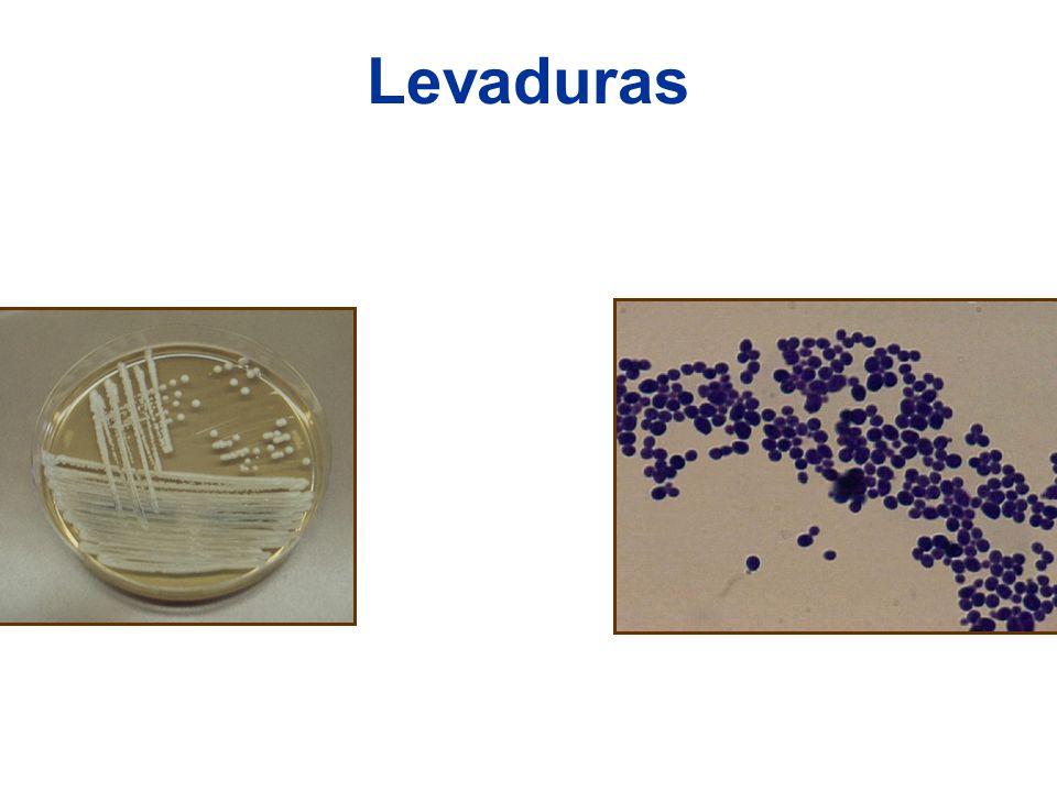 Levaduras