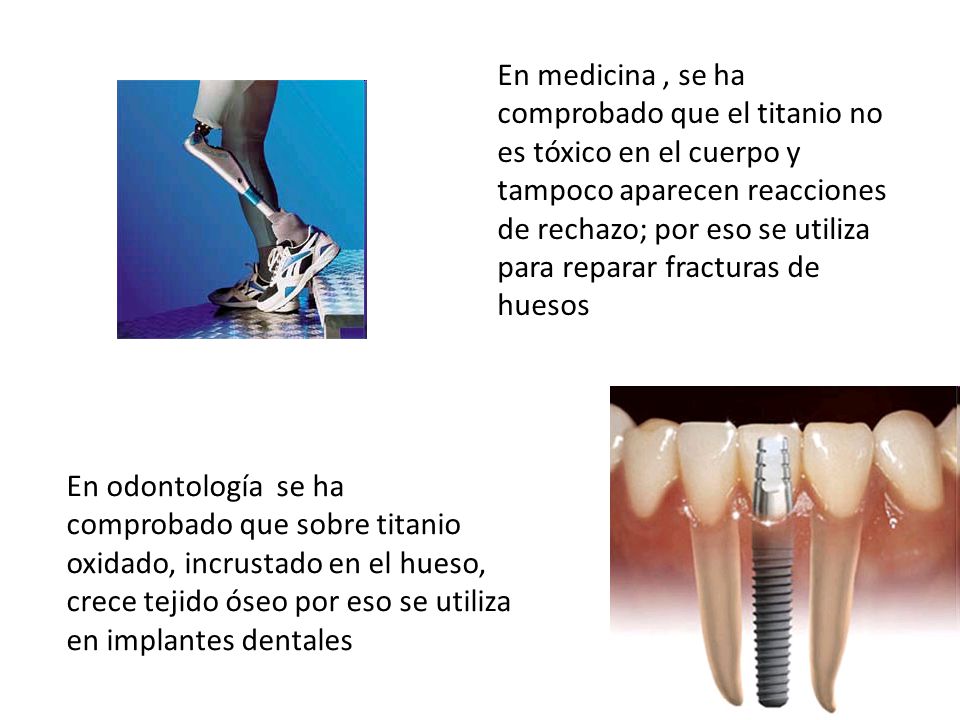 En medicina , se ha comprobado que el titanio no es tóxico en el cuerpo y tampoco aparecen reacciones de rechazo; por eso se utiliza para reparar fracturas de huesos