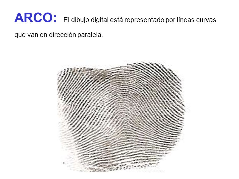 ARCO: El dibujo digital está representado por líneas curvas que van en dirección paralela.