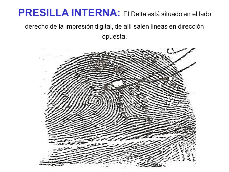 PRESILLA INTERNA: El Delta está situado en el lado derecho de la impresión digital, de allí salen líneas en dirección opuesta.