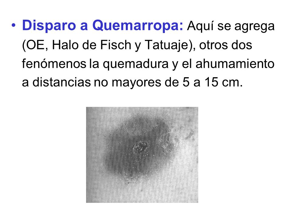 Disparo a Quemarropa: Aquí se agrega (OE, Halo de Fisch y Tatuaje), otros dos fenómenos la quemadura y el ahumamiento a distancias no mayores de 5 a 15 cm.