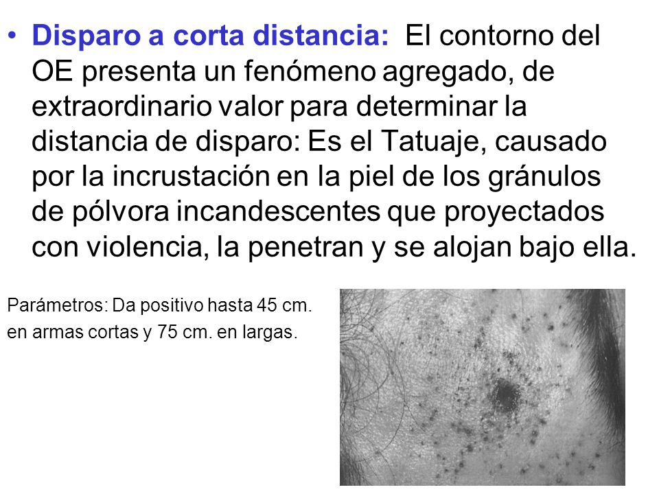 Disparo a corta distancia: El contorno del OE presenta un fenómeno agregado, de extraordinario valor para determinar la distancia de disparo: Es el Tatuaje, causado por la incrustación en la piel de los gránulos de pólvora incandescentes que proyectados con violencia, la penetran y se alojan bajo ella.