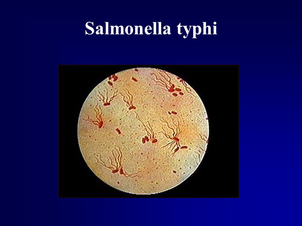 Salmonella typhi