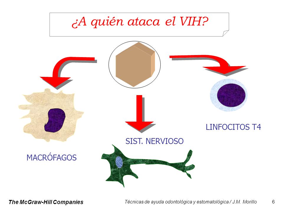 ¿A quién ataca el VIH LINFOCITOS T4 SIST. NERVIOSO MACRÓFAGOS