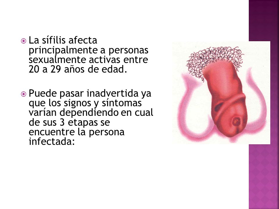 La sífilis afecta principalmente a personas sexualmente activas entre 20 a 29 años de edad.