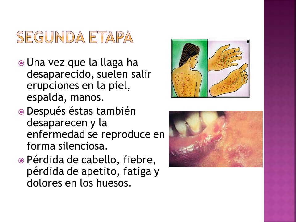 Segunda etapa Una vez que la llaga ha desaparecido, suelen salir erupciones en la piel, espalda, manos.