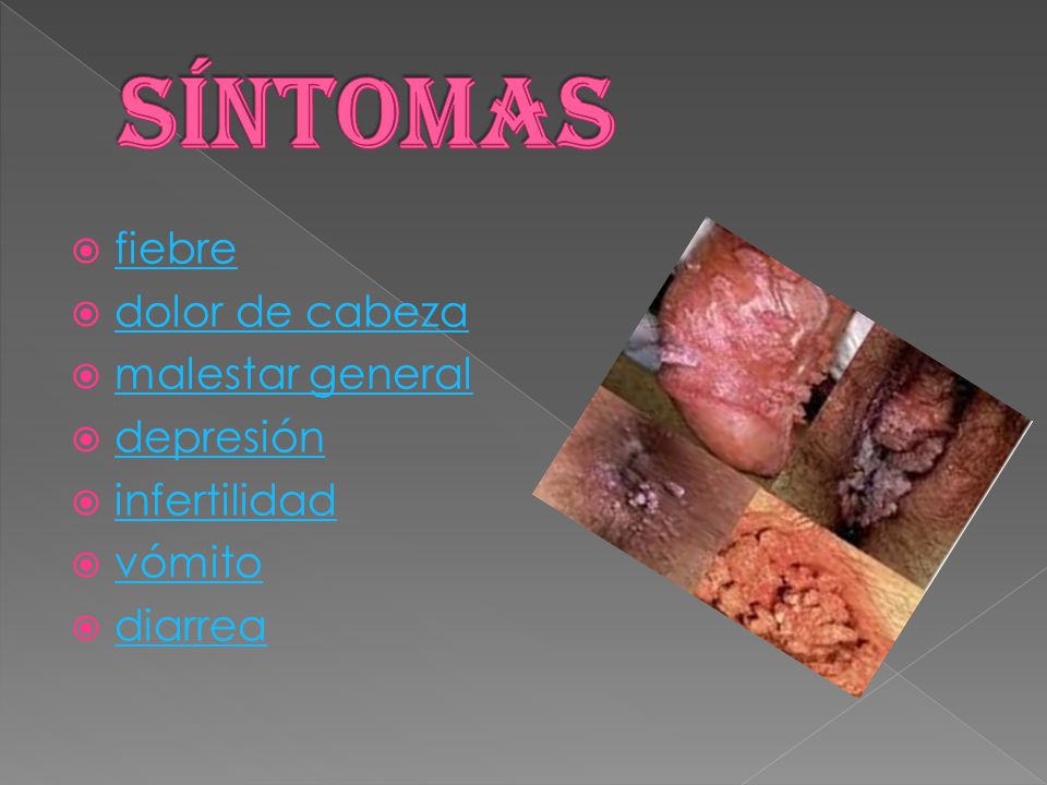 síntomas fiebre dolor de cabeza malestar general depresión