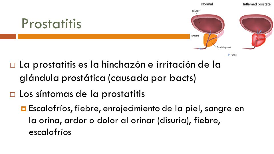 nystatin és prostatitis