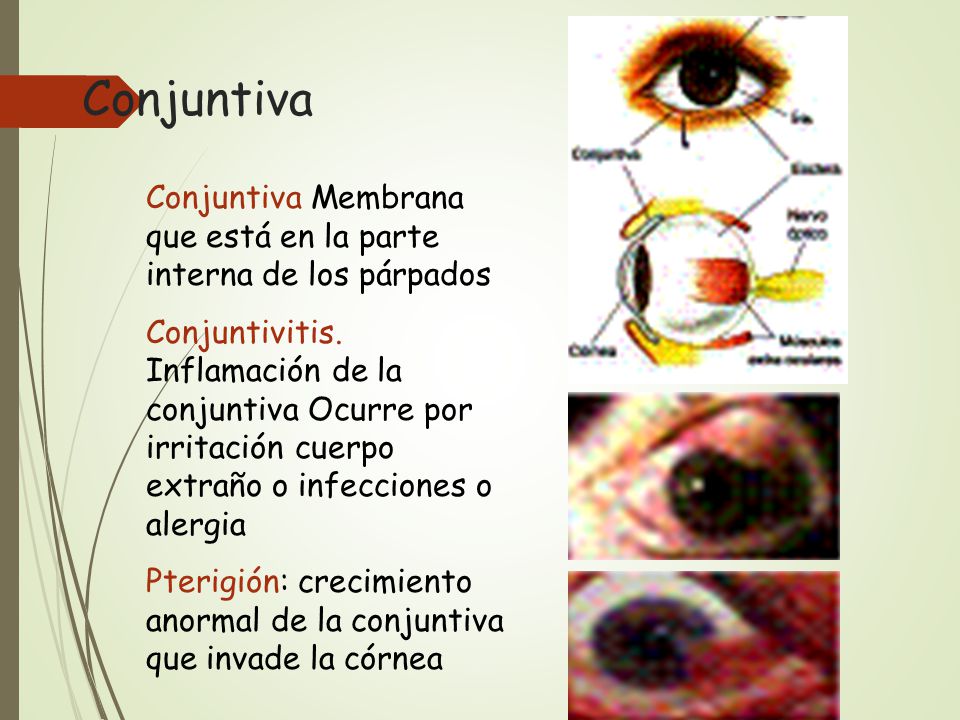 Conjuntiva Conjuntiva Membrana que está en la parte interna de los párpados.