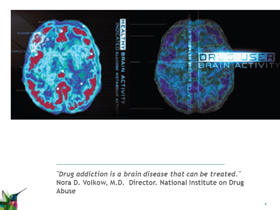 Drug addiction is a brain disease that can be treated. Nora D