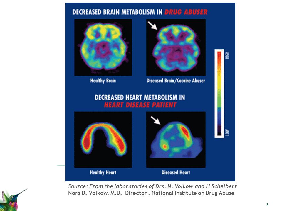 Source: From the laboratories of Drs. N. Volkow and H Schelbert Nora D