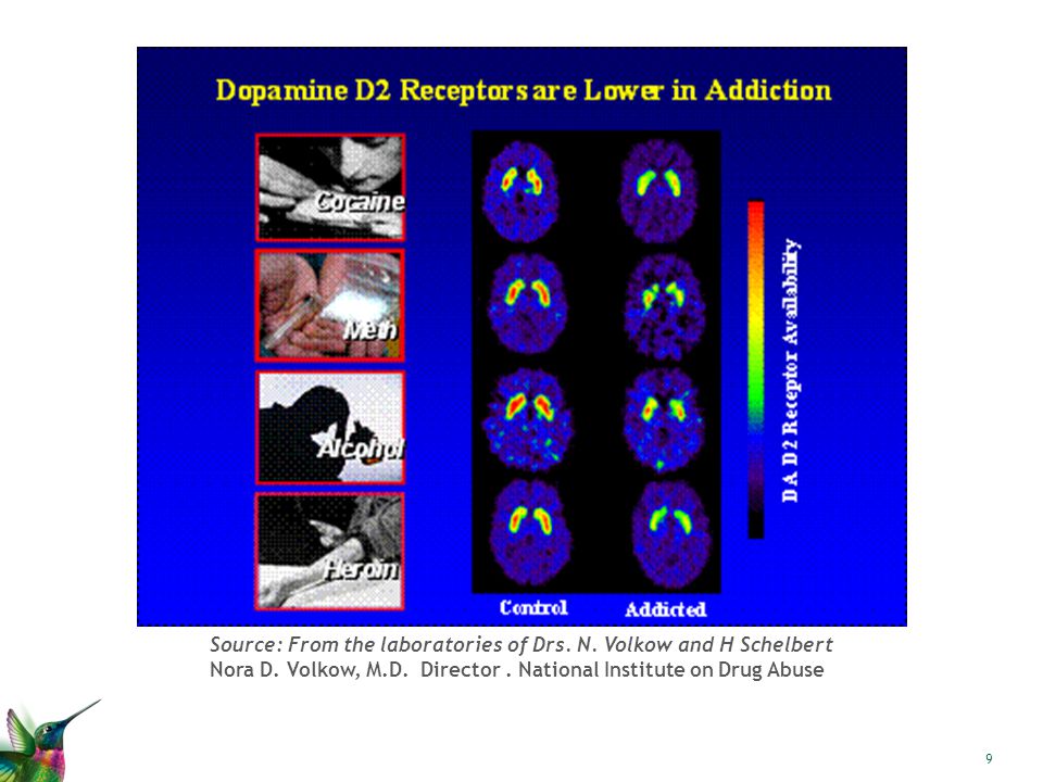 Source: From the laboratories of Drs. N. Volkow and H Schelbert Nora D