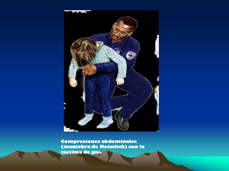 Compresiones abdominales (maniobra de Heimlich) con la victima de pie.