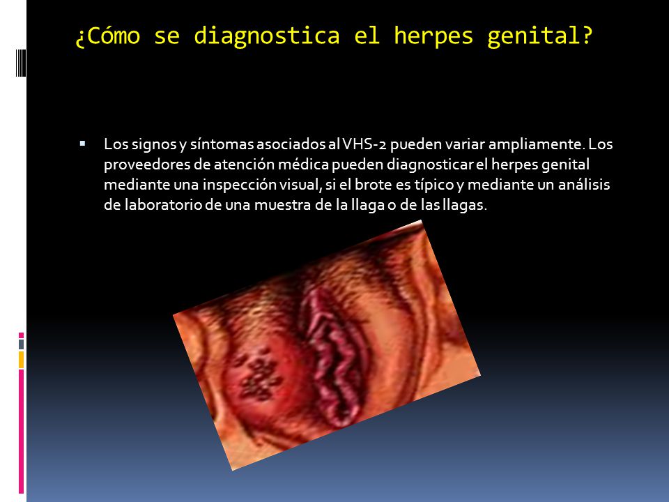 ¿Cómo se diagnostica el herpes genital