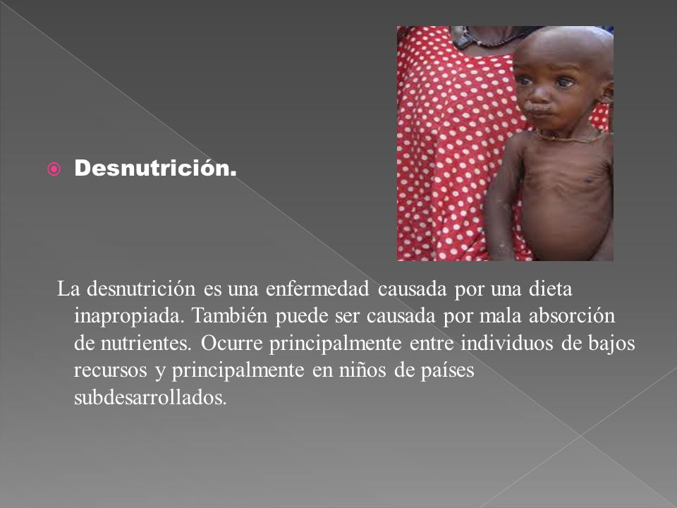 Desnutrición.