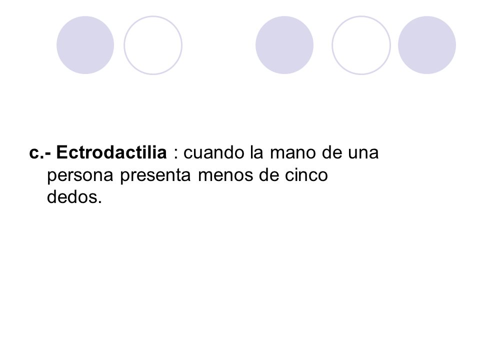 c.- Ectrodactilia : cuando la mano de una persona presenta menos de cinco dedos.