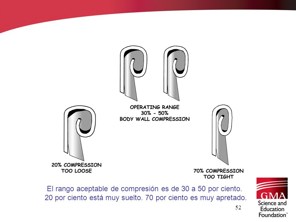 El rango aceptable de compresión es de 30 a 50 por ciento.