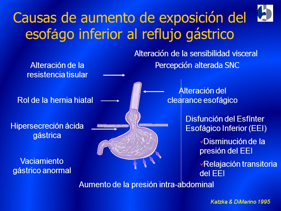 Causas de aumento de exposición del esofágo inferior al reflujo gástrico