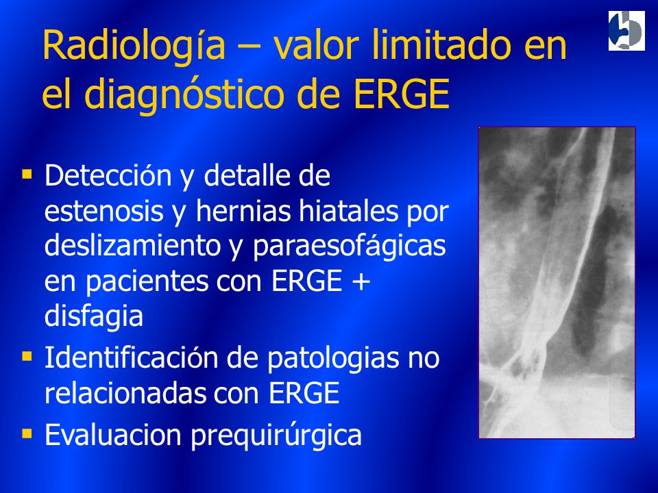 Radiología – valor limitado en el diagnóstico de ERGE