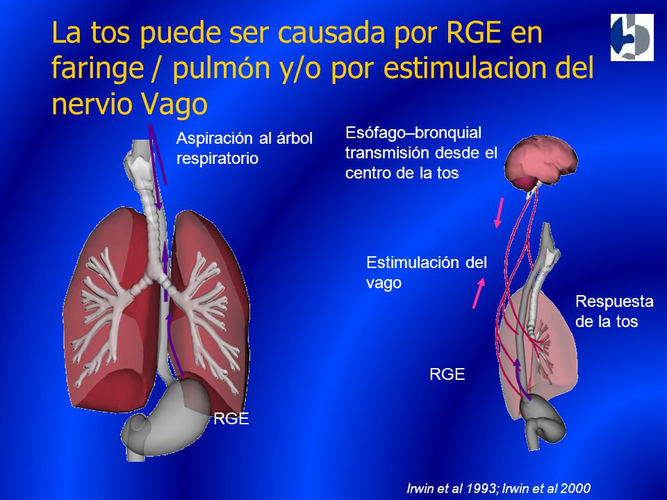 La tos puede ser causada por RGE en faringe / pulmón y/o por estimulacion del nervio Vago