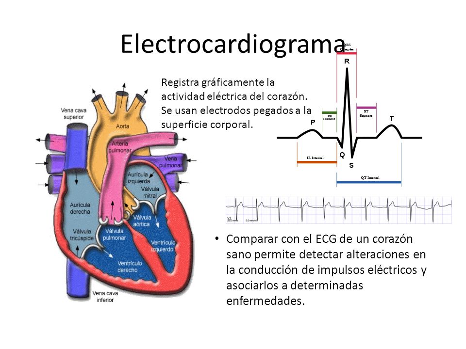 Electrocardiograma Registra gráficamente la actividad eléctrica del corazón. Se usan electrodos pegados a la superficie corporal.