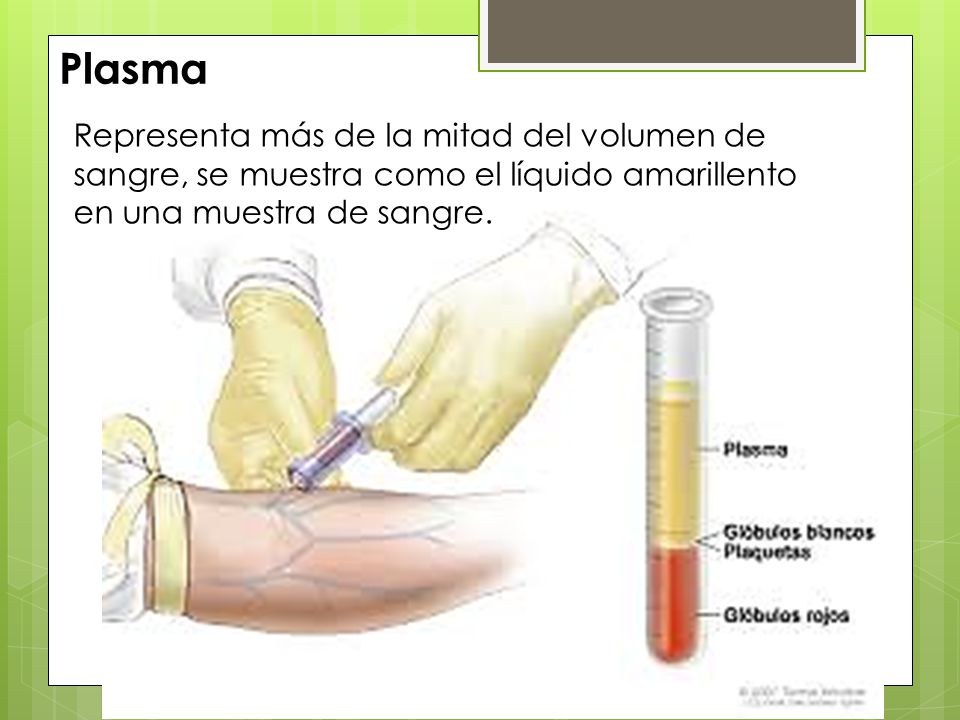 Plasma Representa más de la mitad del volumen de sangre, se muestra como el líquido amarillento en una muestra de sangre.