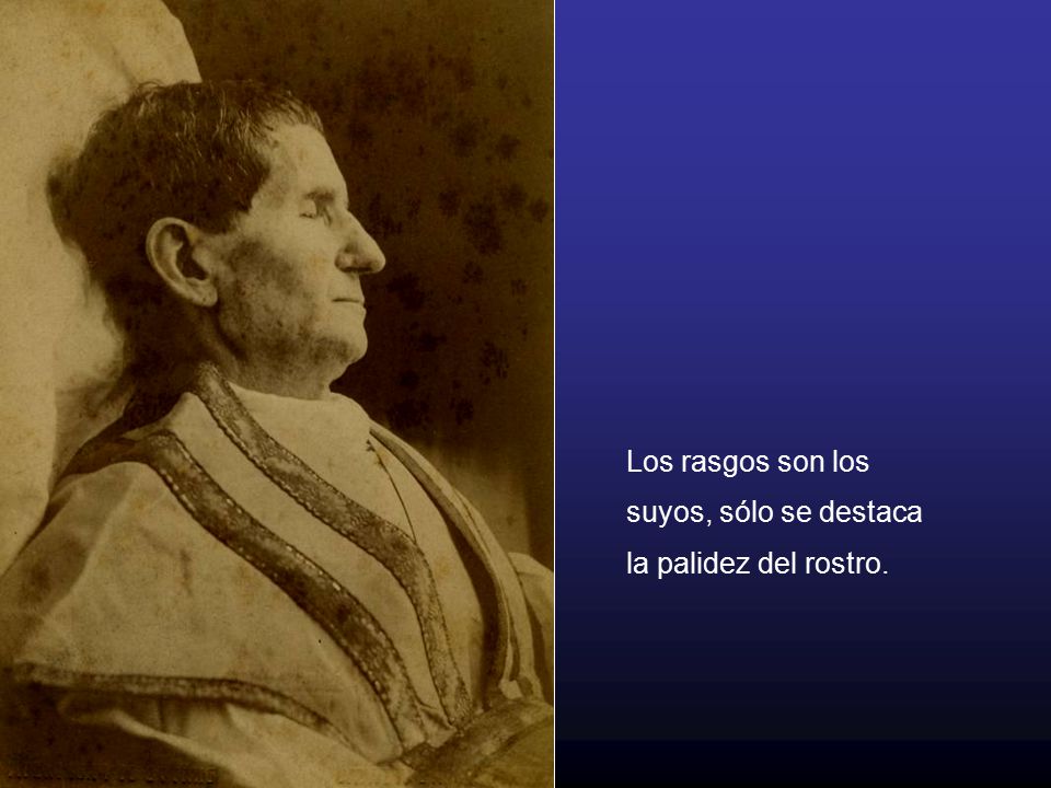 Los rasgos son los suyos, sólo se destaca la palidez del rostro.