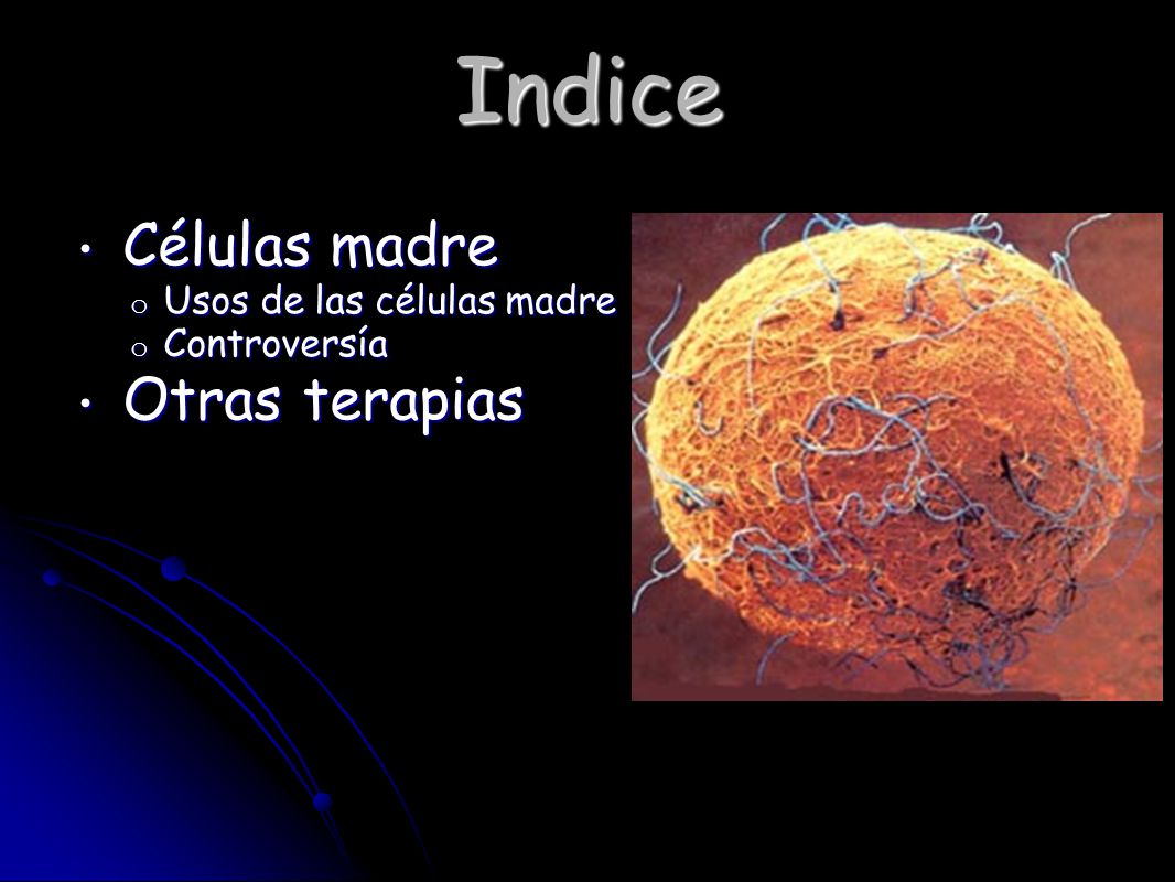 Células madre Usos de las células madre Controversía Otras terapias