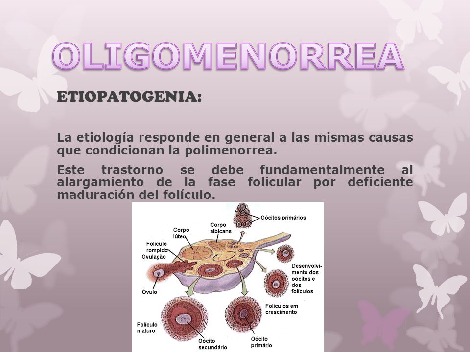 OLIGOMENORREA ETIOPATOGENIA: