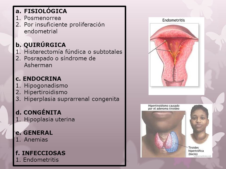 FISIOLÓGICA Posmenorrea. Por insuficiente proliferación endometrial. b. QUIRÚRGICA. Histerectomía fúndica o subtotales.