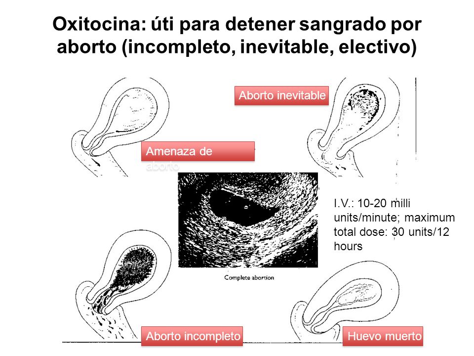 Oxitocina: úti para detener sangrado por aborto (incompleto, inevitable, electivo)