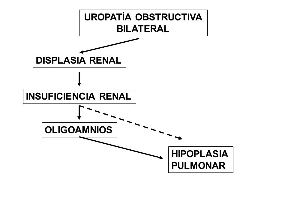 DISPLASIA RENAL UROPATÍA OBSTRUCTIVA BILATERAL INSUFICIENCIA RENAL OLIGOAMNIOS HIPOPLASIA PULMONAR