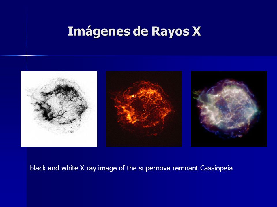 Imágenes de Rayos X black and white X-ray image of the supernova remnant Cassiopeia