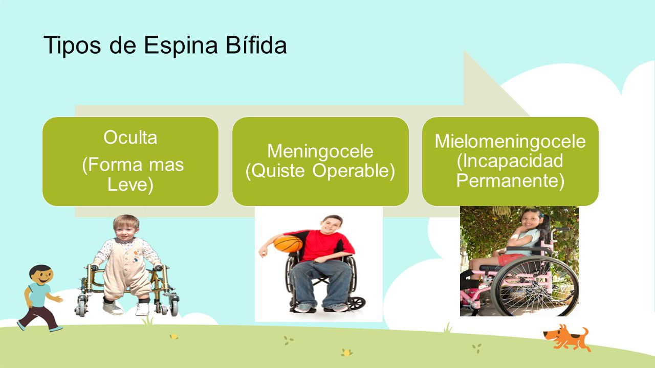 Tipos de Espina Bífida Mielomeningocele (Incapacidad Permanente)